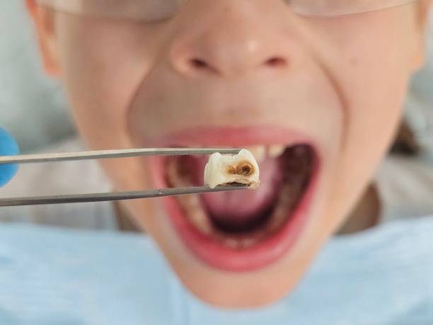 Best Emergency Dentist for Special Needs Patients in Grant Park, IL